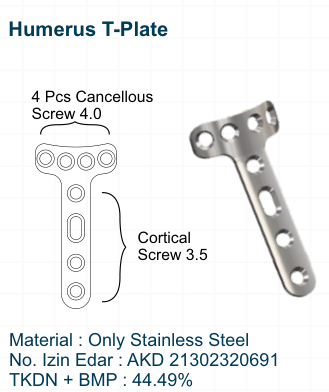 Humerus T-Plate
