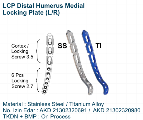 LCP Distal Humerus Medial Locking Plate (LR)
