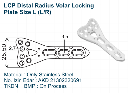 LCP Distal Radius Volar Locking Plate Size L (LR)