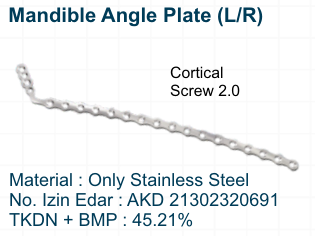 Mandible Angle Plate (LR)