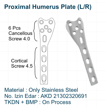Proximal Humerus Plate (LR)