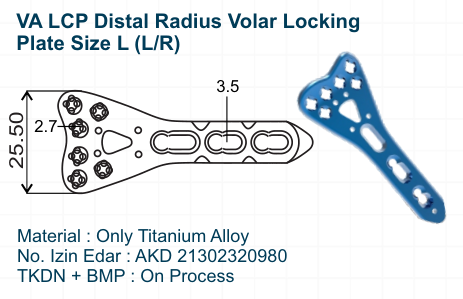 VA LCP Distal Radius Volar Locking Plate Size L (LR)