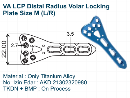 VA LCP Distal Radius Volar Locking Plate Size M (LR)